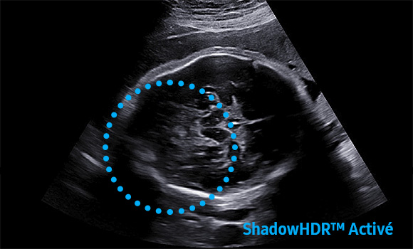 ShadowHDR™