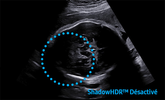 ShadowHDR™