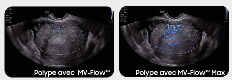 NEW – MV-Flow Max™¹